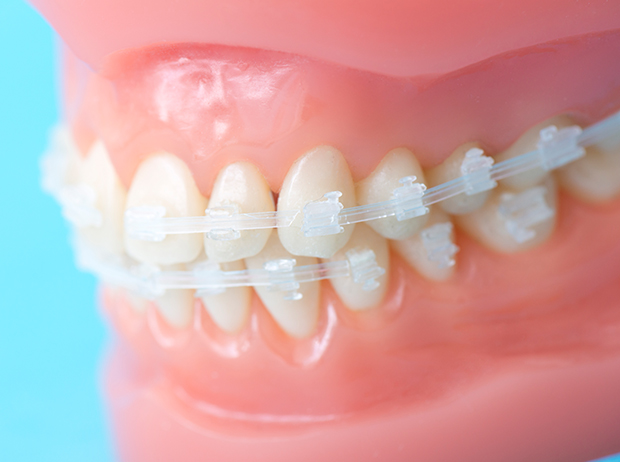 ORTHODONTICS 歯並びを整える矯正歯科